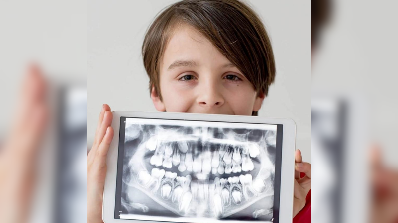 Are Dental X-rays Safe?